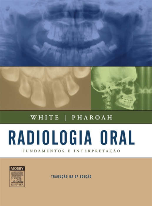 Radiologia oral: Fundamentos e interpretação