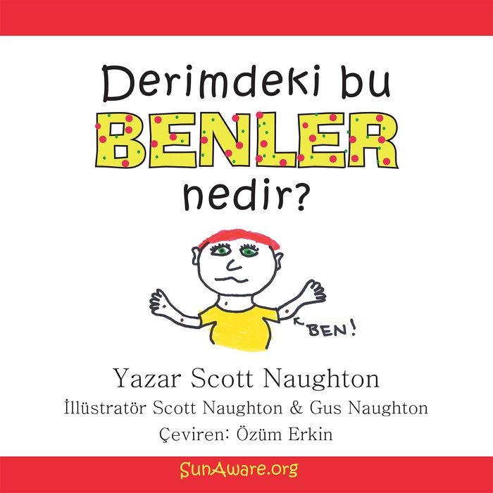 Derimdeki bu benler nedir?