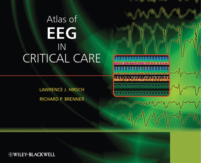 Atlas of EEG in Critical Care