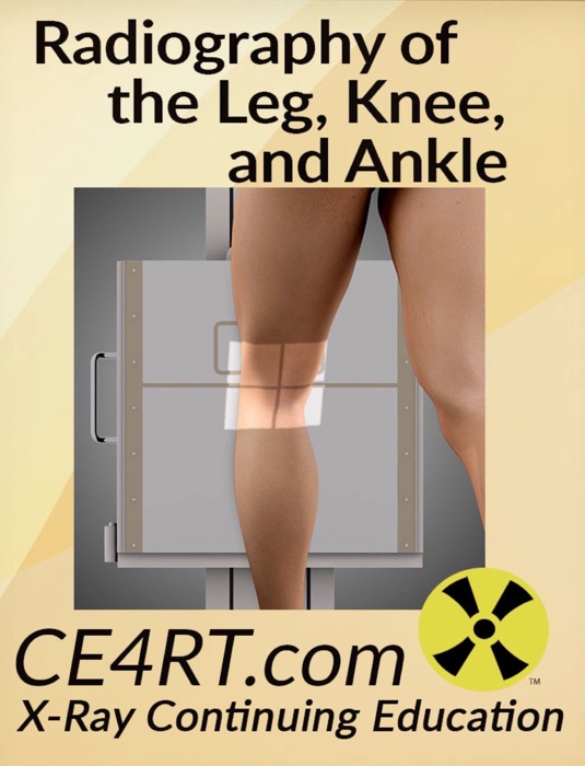 Radiography of the Leg, Knee and Ankle