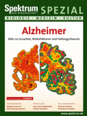 Alzheimer - Spektrum der Wissenschaft