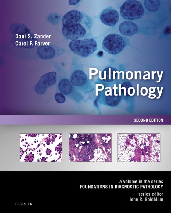 Pulmonary Pathology eBook