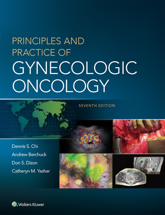 Principles and Practice of Gynecologic Oncology