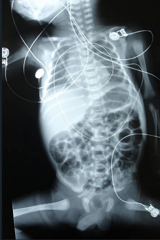 X-rays screenshot 3