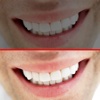 Dental Pic Compare