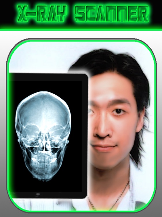 X-Ray Scanner HD for iPad
