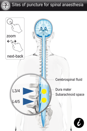 Spinal Vademecum(圖3)-速報App