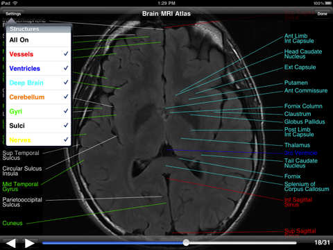 Brain MRI Atlas screenshot 3