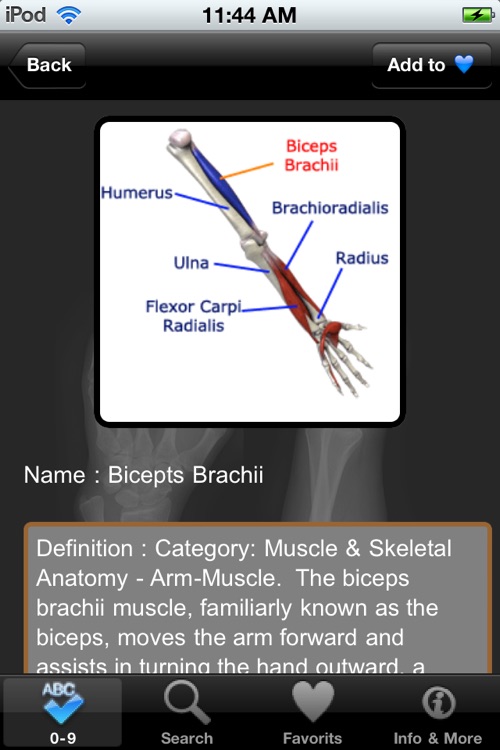 VISUAL: Muscle & Skeletal Anatomy