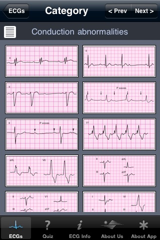 ECG Pocket Reference