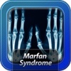 Marfan Syndrome