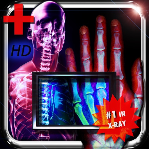 Amazing X-Ray FX ² FREE+ iOS App