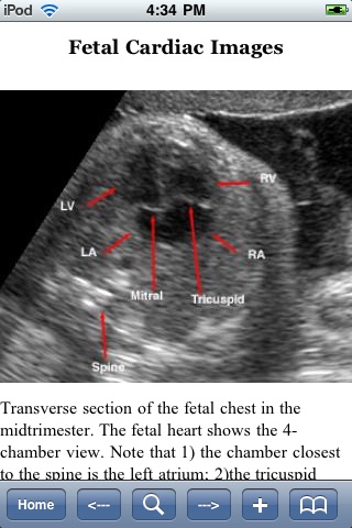 Handbook of High-Risk Obstetrics screenshot-3