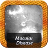 Macula Disease