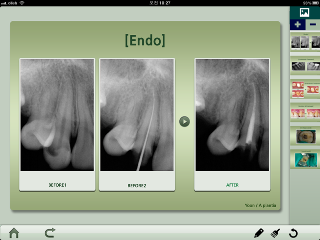 Dental iClinic lite(圖5)-速報App