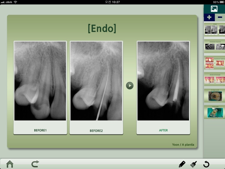 Dental iClinic lite screenshot-4