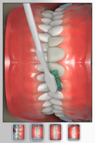 Dr. Boutin Orthodontics: CavityFree 3D