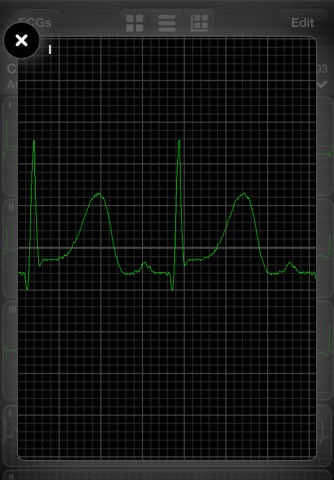 AirStrip - Cardiology screenshot 2