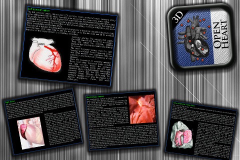 Open Heart 3D St screenshot 4