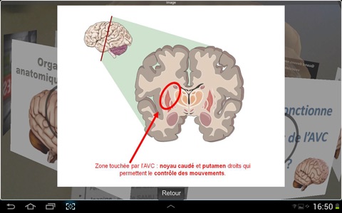 Cerebro screenshot 3