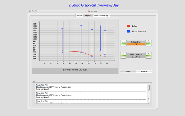 BpGrapher - BloodPressure+Pulse(圖2)-速報App
