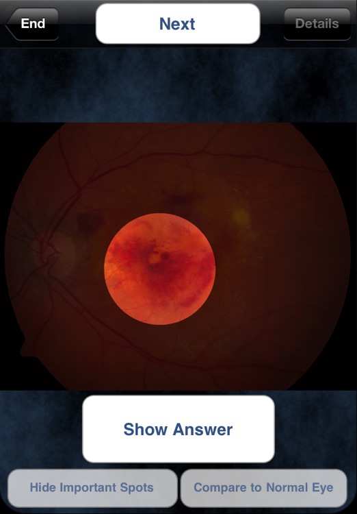 iEye Retina screenshot-4