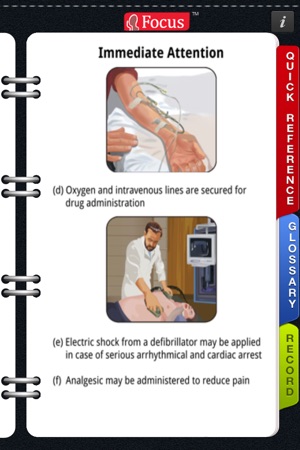 Animated Quick Reference - Cardiac Events(圖4)-速報App