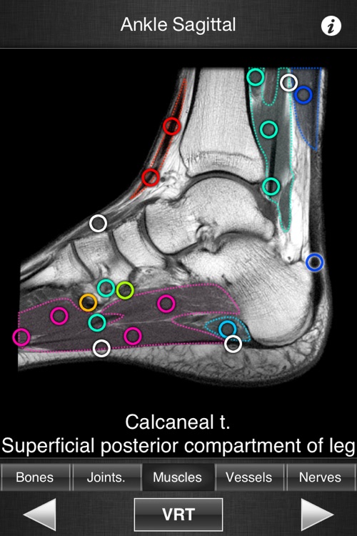 Monster Anatomy HD - Lower Limb screenshot-3