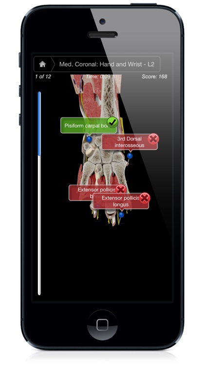 Hand & Wrist Pro III with Animations - iPhone Edition