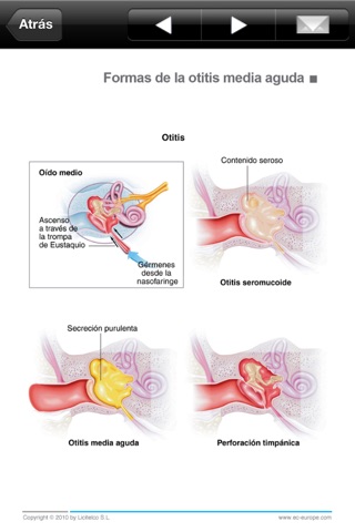 Miniatlas Ear, Nose & Throat screenshot 3