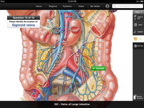 Netter’s Anatomy Atlas Free screenshot 4