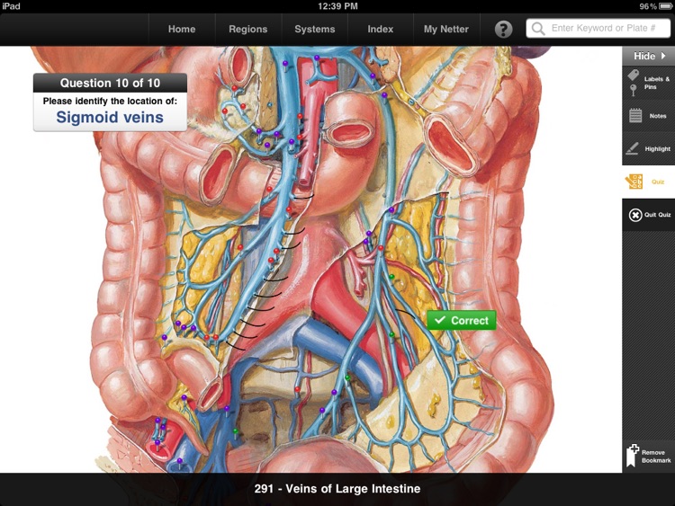Netter’s Anatomy Atlas Free screenshot-3