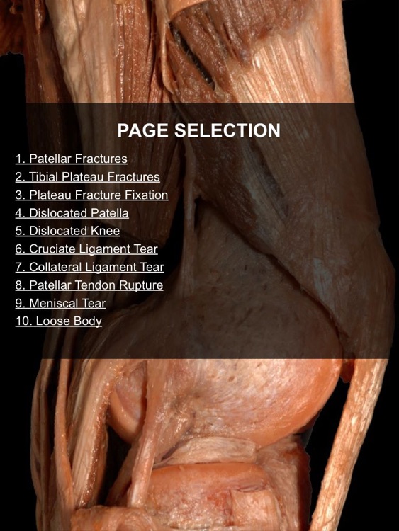 Exploring Essential Orthopaedics screenshot-4