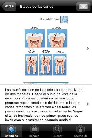 Miniatlas Dentistry screenshot 3