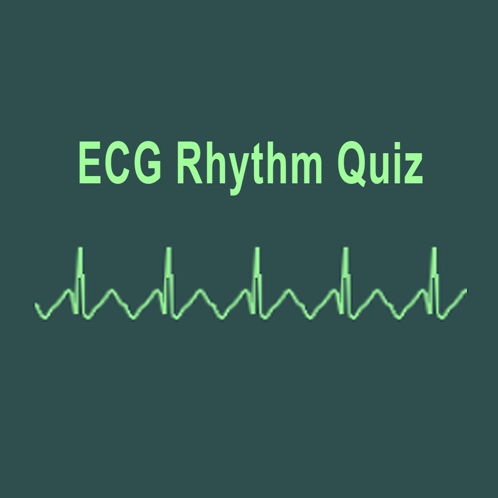 ECG Rhythm Quiz