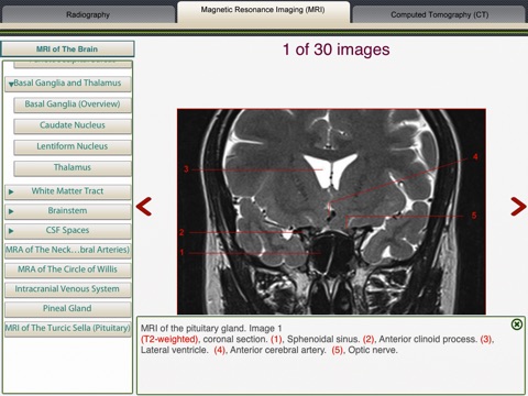 MRI-Xray Human Body screenshot 4