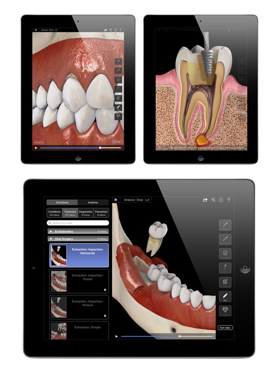Dental Patient Education Lite