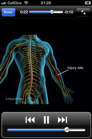 Animated Quick Reference Guide - Backpain screenshot 3