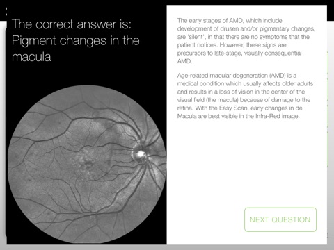 EasyScan Retina Academy screenshot 3