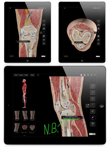 Knee Pro III for iPad screenshot 3