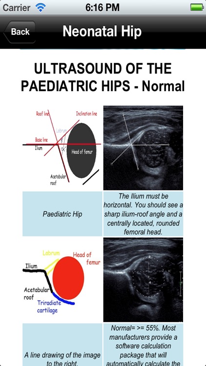 Ultrasoundpaedia