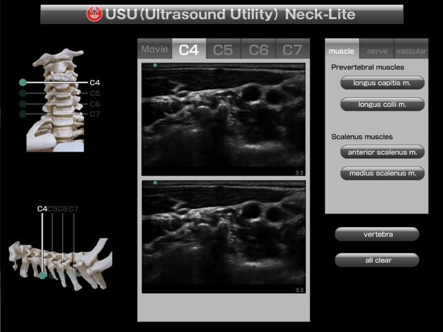 USU neck-lite(圖1)-速報App