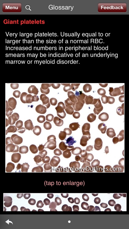 Hematology Outlines: HH Rashidi MD & JC Nguyen MD