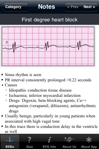 ECG Pocket Reference screenshot 2