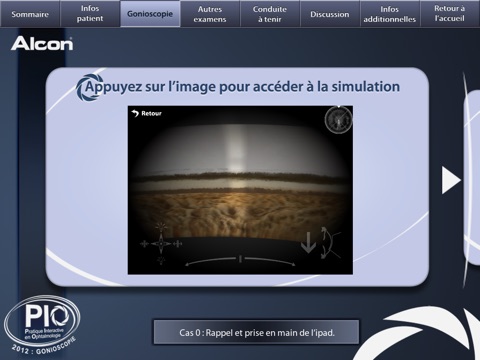 Alcon Gonioscopie screenshot 4