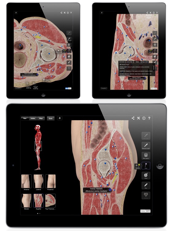 Hip Pro III for iPad
