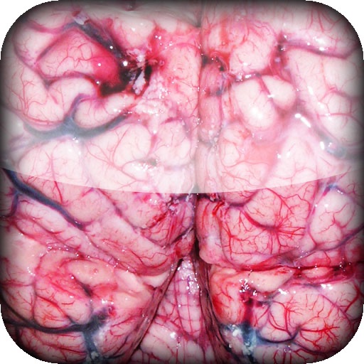 Brain Rot iOS App
