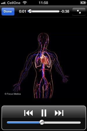 Animated Quick Reference - Cardiac Events(圖3)-速報App