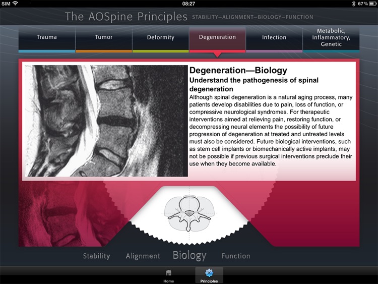 The AOSpine Principles screenshot-4