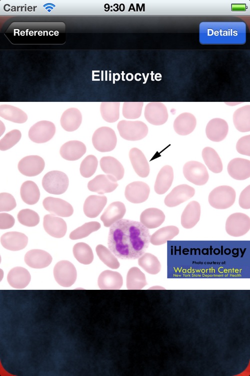 iHematology screenshot-4